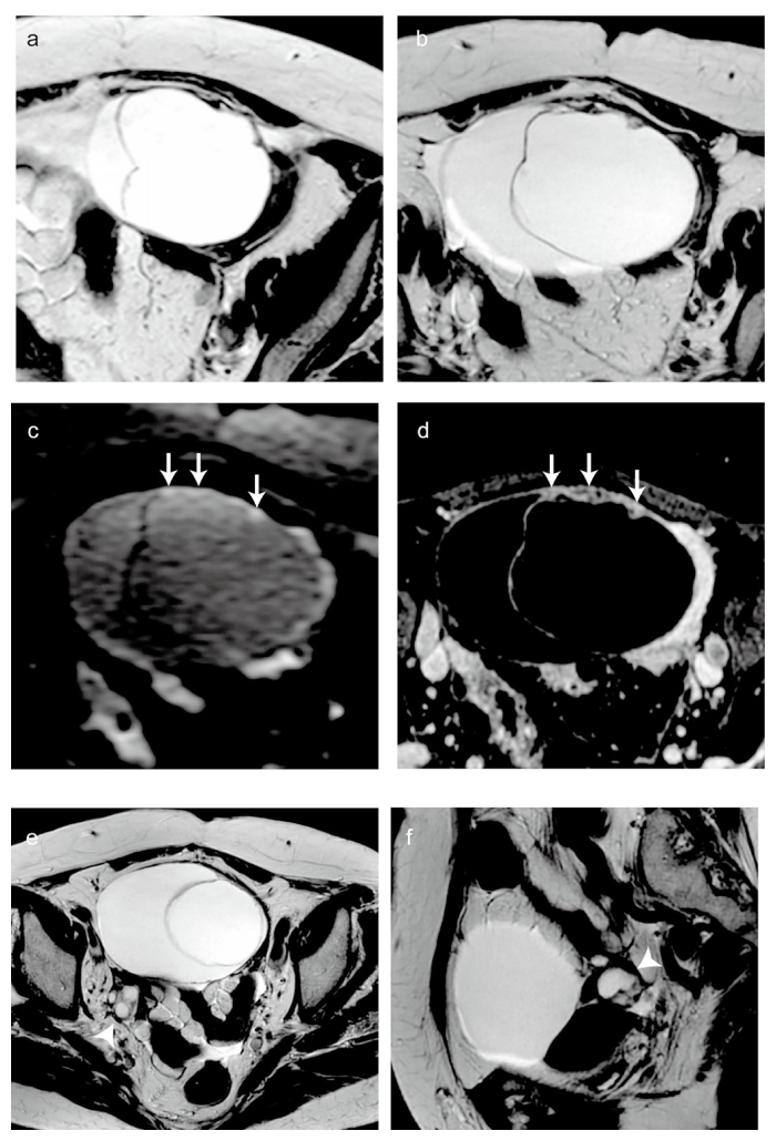 Fig.1