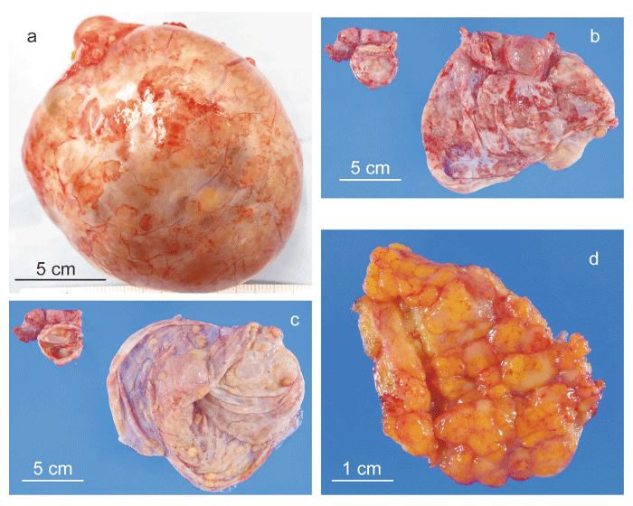Fig.2